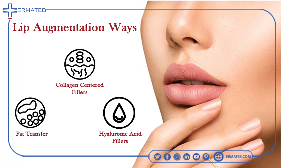 lip augmentation ways